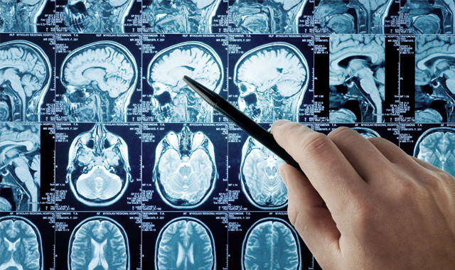 neurochirurg zielona g&oacute;ra